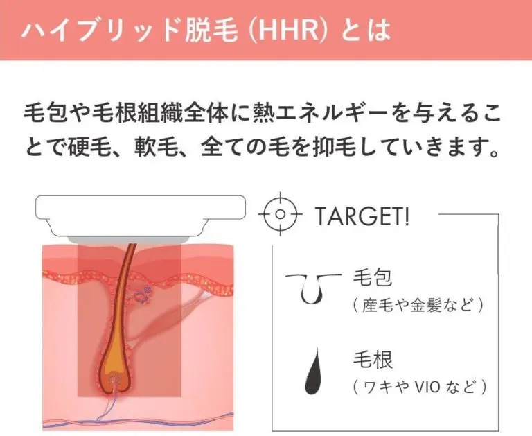 脱毛機の紹介 米子脱毛サロンヒカリ